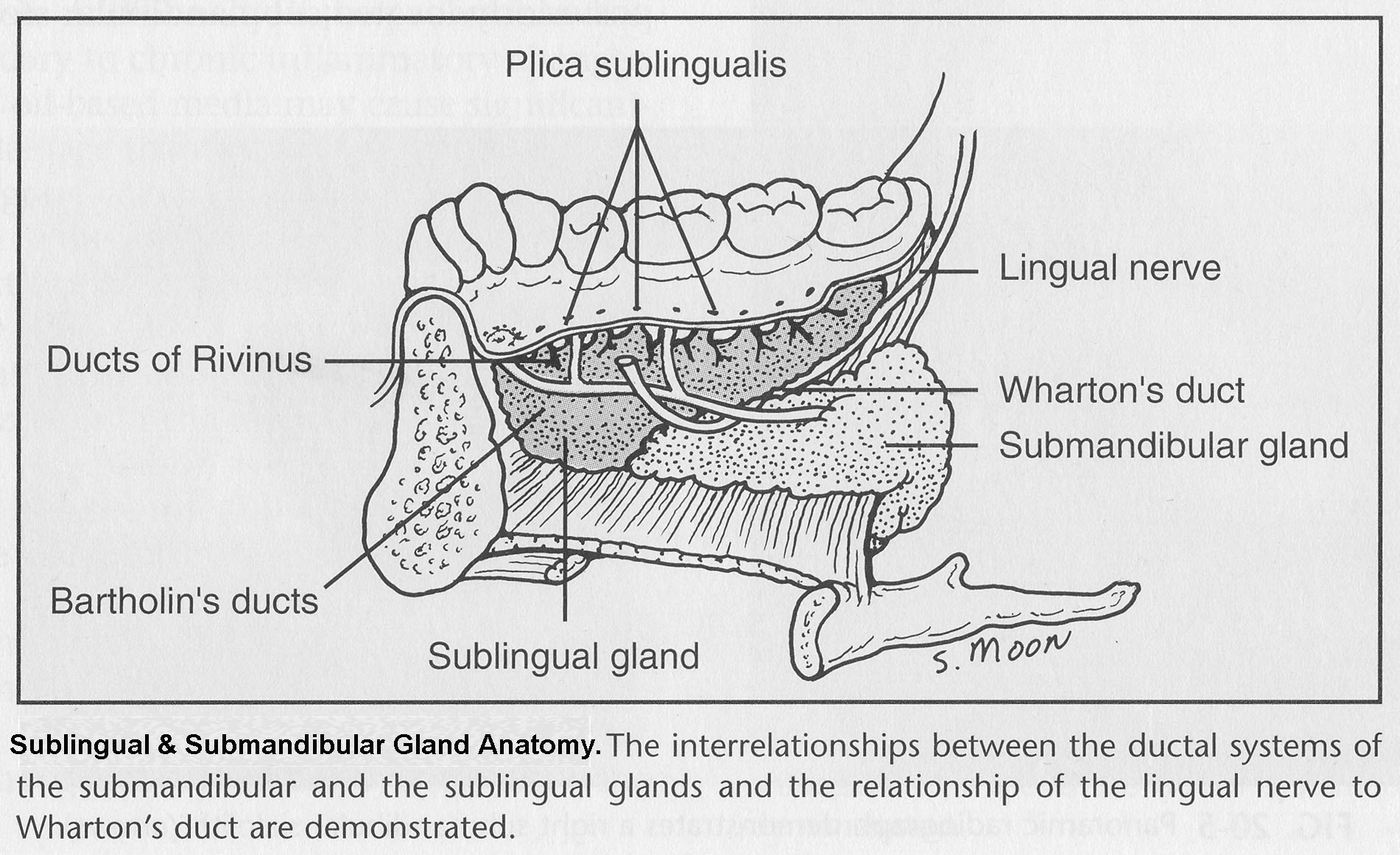 Sublingual Gland Removal26